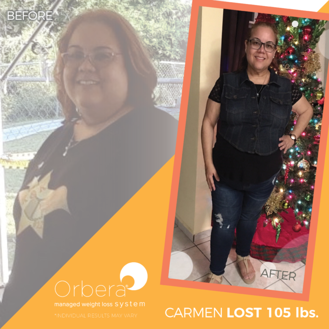 2019-Aug-OBERA-BeforeAfter-1080x1080-FNL-Carmen105