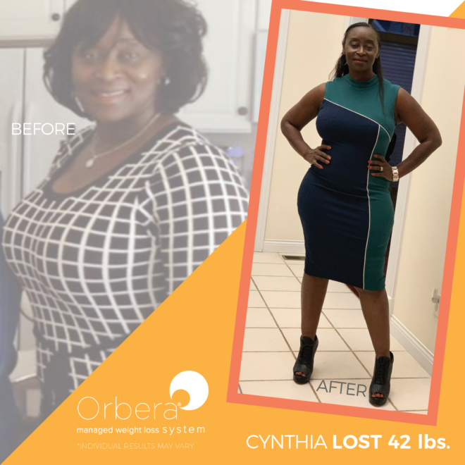 2019-Aug-OBERA-BeforeAfter-1080x1080-FNL-Cynthia42