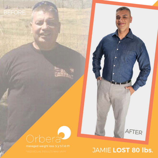 2019-Aug-OBERA-BeforeAfter-1080x1080-FNL-Jamie80