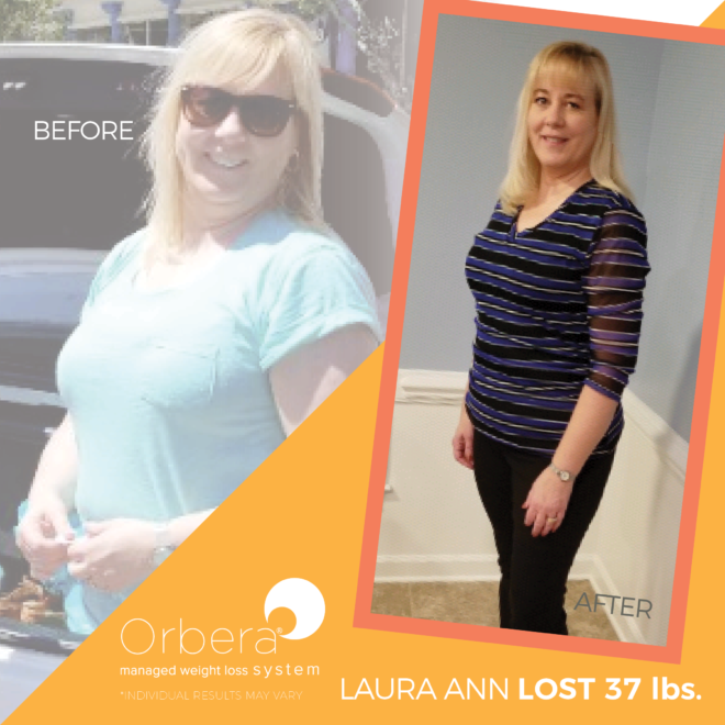 2019-Aug-OBERA-BeforeAfter-1080x1080-FNL-LauraAnn37